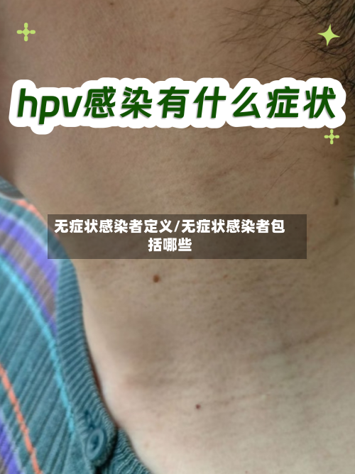 无症状感染者定义/无症状感染者包括哪些