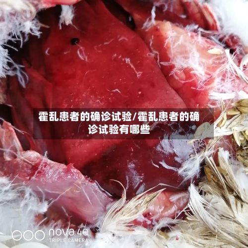 霍乱患者的确诊试验/霍乱患者的确诊试验有哪些