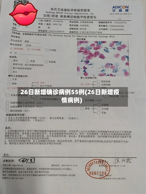 26日新增确诊病例55例(26日新增疫情病例)