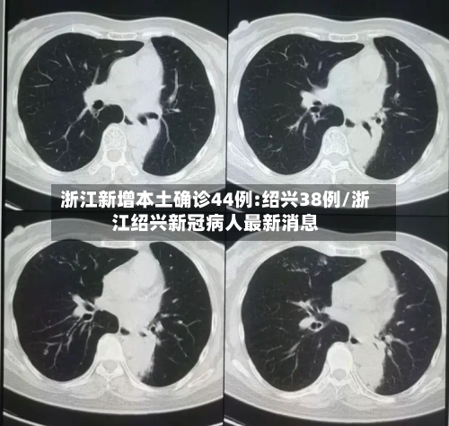浙江新增本土确诊44例:绍兴38例/浙江绍兴新冠病人最新消息