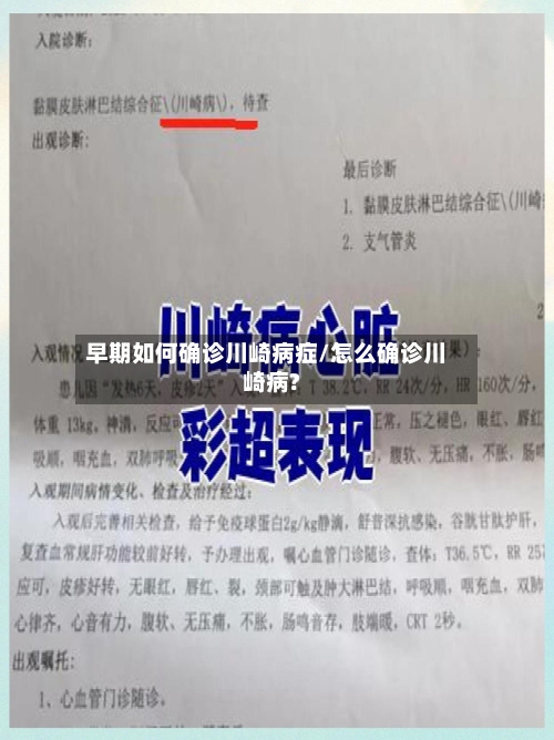 早期如何确诊川崎病症/怎么确诊川崎病?