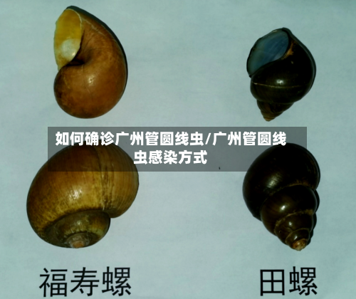 如何确诊广州管圆线虫/广州管圆线虫感染方式
