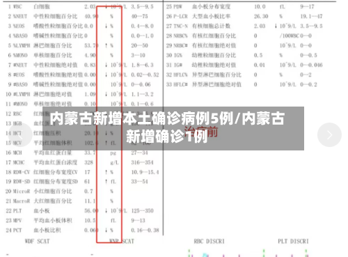 内蒙古新增本土确诊病例5例/内蒙古新增确诊1例