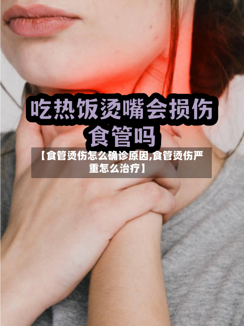【食管烫伤怎么确诊原因,食管烫伤严重怎么治疗】