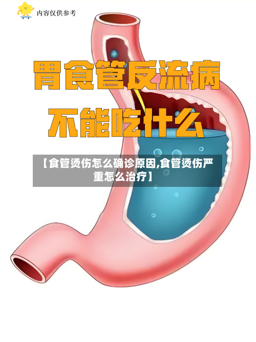 【食管烫伤怎么确诊原因,食管烫伤严重怎么治疗】