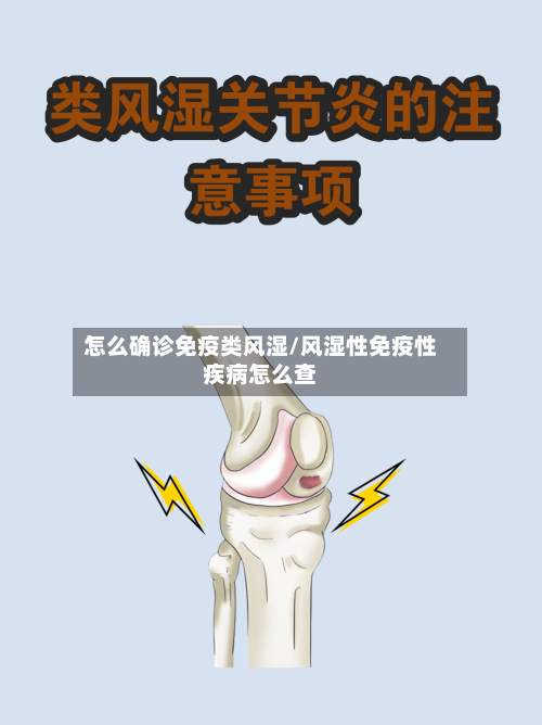 怎么确诊免疫类风湿/风湿性免疫性疾病怎么查