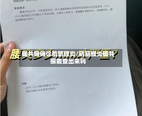 磁共振确诊肌筋膜炎/肌筋膜炎磁共振能查出来吗