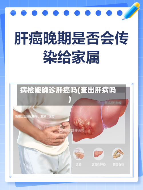 病检能确诊肝癌吗(查出肝病吗)