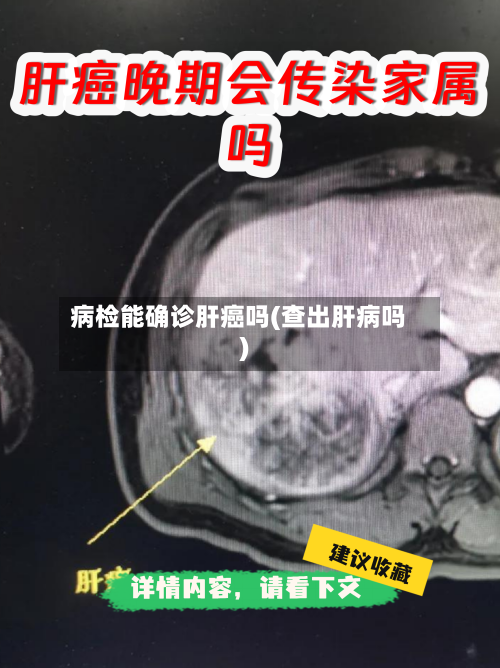 病检能确诊肝癌吗(查出肝病吗)