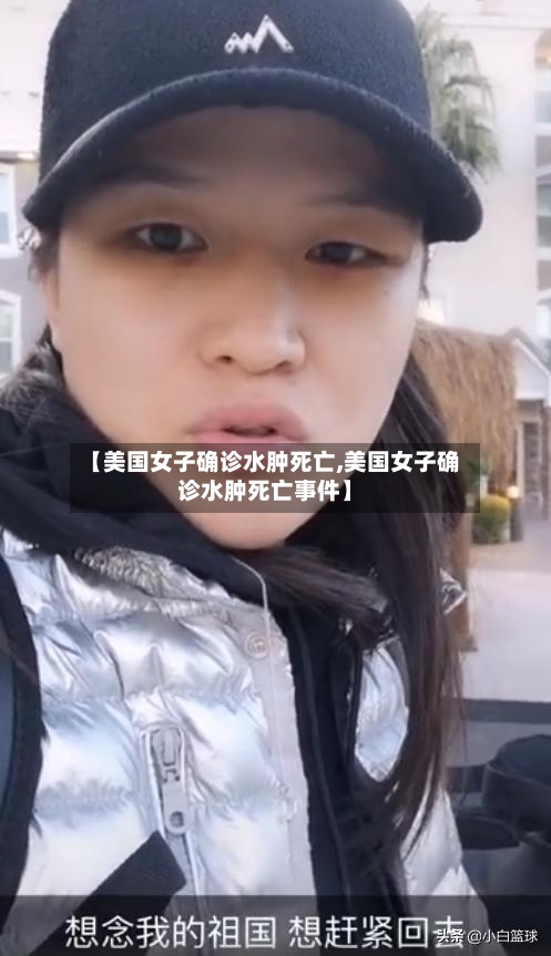 【美国女子确诊水肿死亡,美国女子确诊水肿死亡事件】