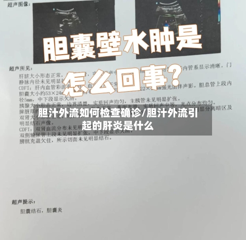 胆汁外流如何检查确诊/胆汁外流引起的肝炎是什么