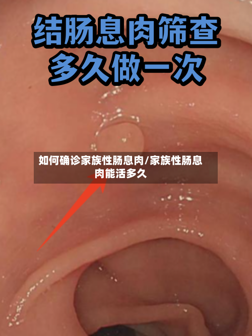 如何确诊家族性肠息肉/家族性肠息肉能活多久