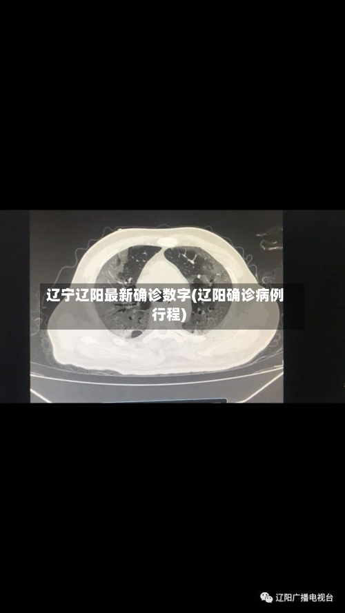 辽宁辽阳最新确诊数字(辽阳确诊病例行程)