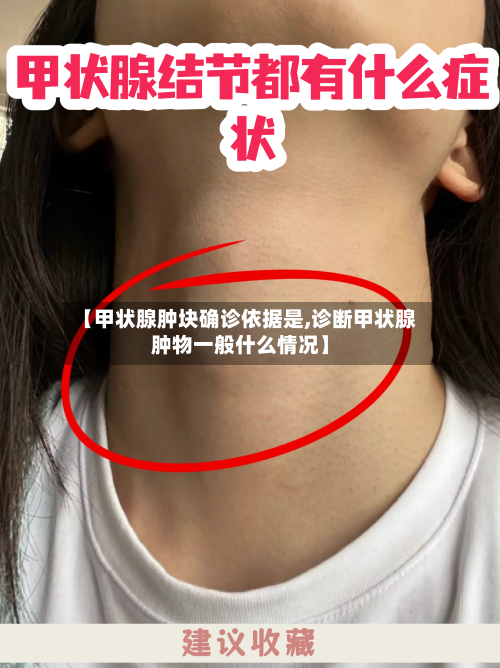 【甲状腺肿块确诊依据是,诊断甲状腺肿物一般什么情况】