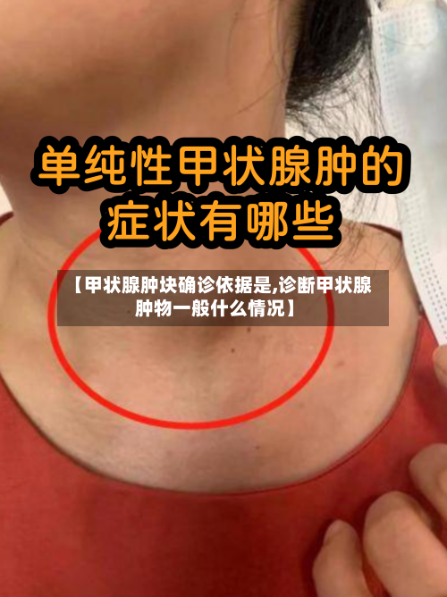 【甲状腺肿块确诊依据是,诊断甲状腺肿物一般什么情况】