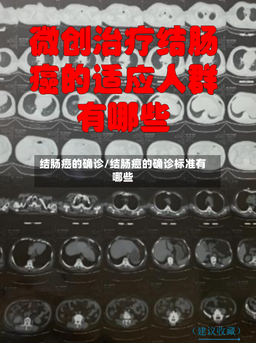 结肠癌的确诊/结肠癌的确诊标准有哪些