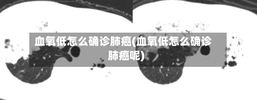 血氧低怎么确诊肺癌(血氧低怎么确诊肺癌呢)