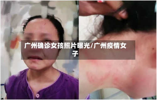广州确诊女孩照片曝光/广州疫情女子