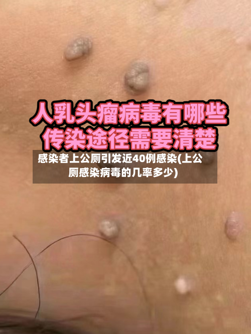 感染者上公厕引发近40例感染(上公厕感染病毒的几率多少)