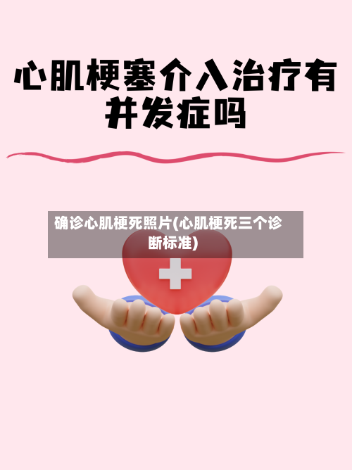 确诊心肌梗死照片(心肌梗死三个诊断标准)