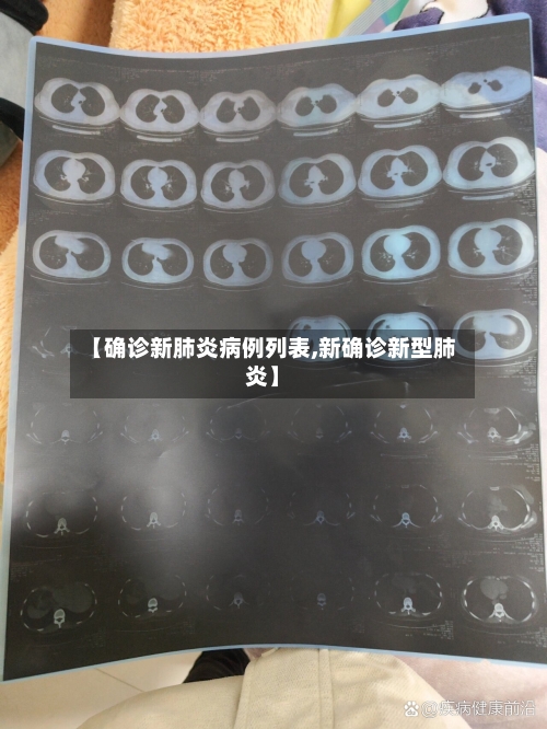【确诊新肺炎病例列表,新确诊新型肺炎】