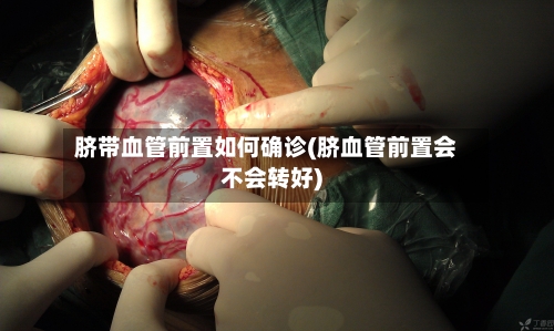 脐带血管前置如何确诊(脐血管前置会不会转好)