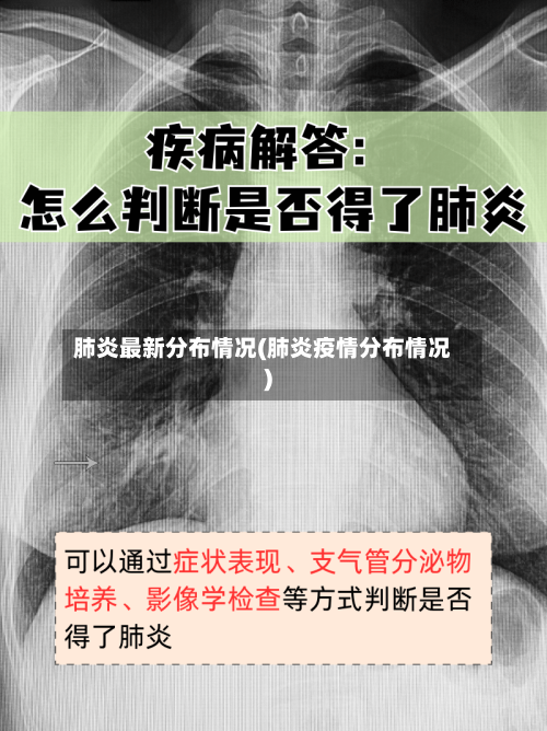 肺炎最新分布情况(肺炎疫情分布情况)