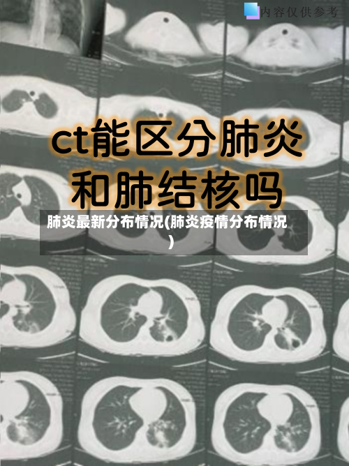 肺炎最新分布情况(肺炎疫情分布情况)