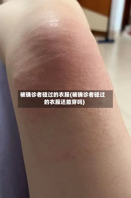 被确诊者碰过的衣服(被确诊者碰过的衣服还能穿吗)