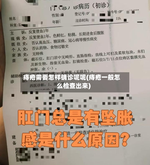 痔疮需要怎样确诊呢呢(痔疮一般怎么检查出来)