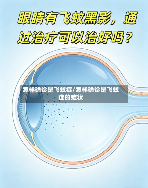 怎样确诊是飞蚊症/怎样确诊是飞蚊症的症状
