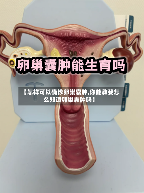 【怎样可以确诊卵巢囊肿,你能教我怎么知道卵巢囊肿吗】