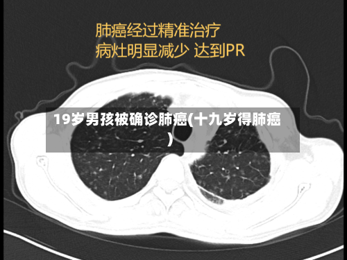 19岁男孩被确诊肺癌(十九岁得肺癌)