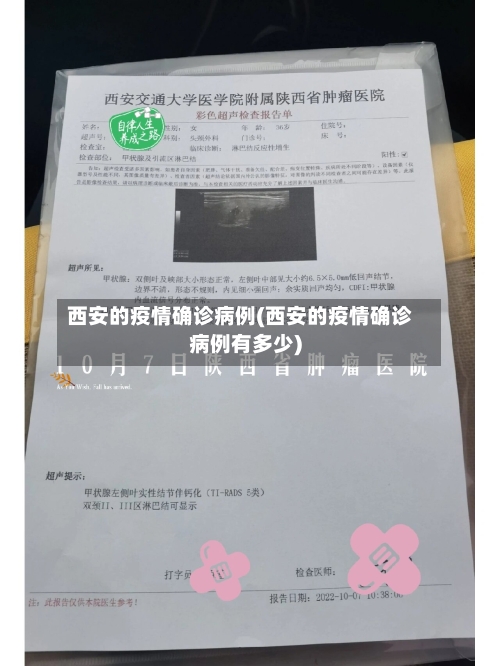 西安的疫情确诊病例(西安的疫情确诊病例有多少)