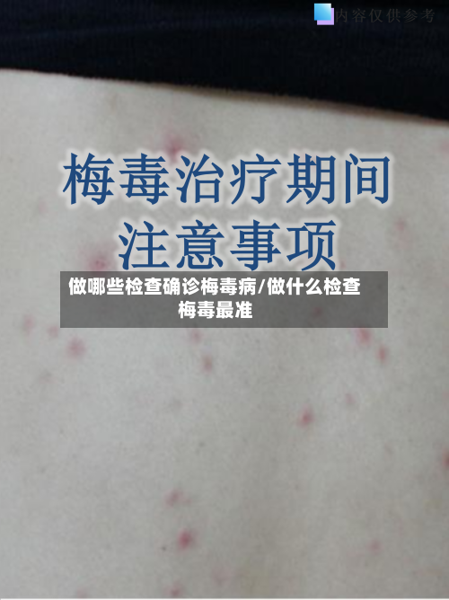 做哪些检查确诊梅毒病/做什么检查梅毒最准