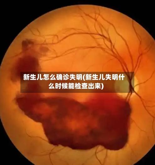 新生儿怎么确诊失明(新生儿失明什么时候能检查出来)