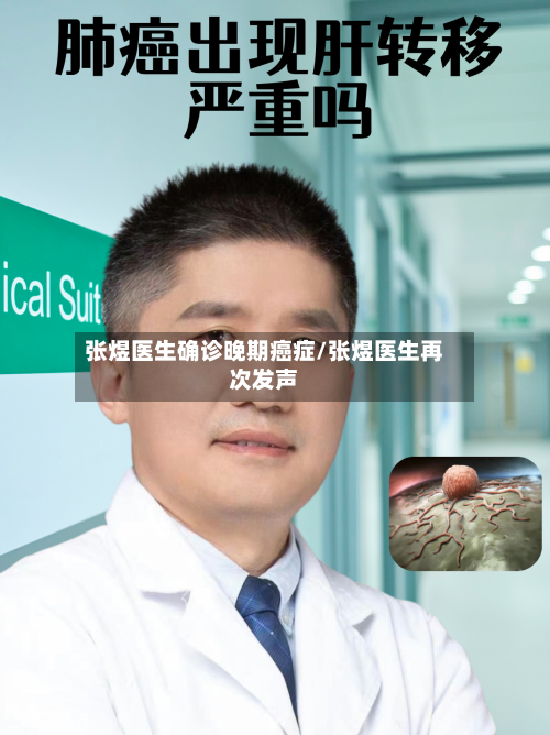 张煜医生确诊晚期癌症/张煜医生再次发声