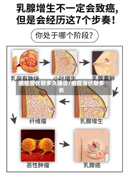 癌症潜伏期多久确诊/癌症潜伏期多长
