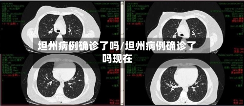 坦州病例确诊了吗/坦州病例确诊了吗现在