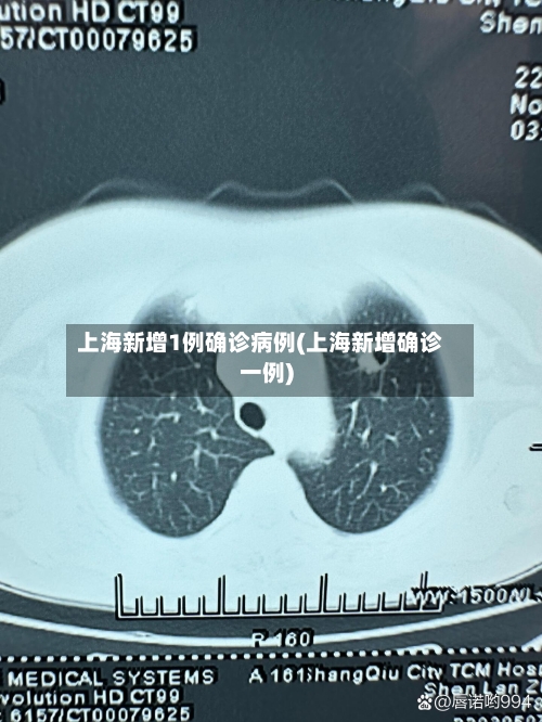 上海新增1例确诊病例(上海新增确诊一例)