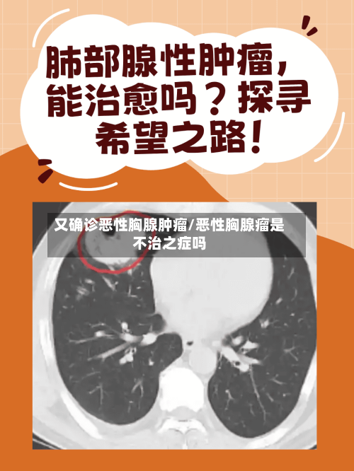 又确诊恶性胸腺肿瘤/恶性胸腺瘤是不治之症吗