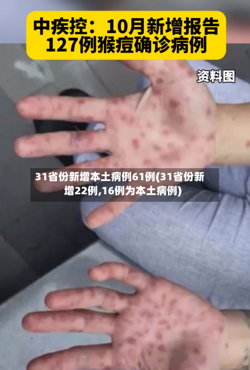 31省份新增本土病例61例(31省份新增22例,16例为本土病例)