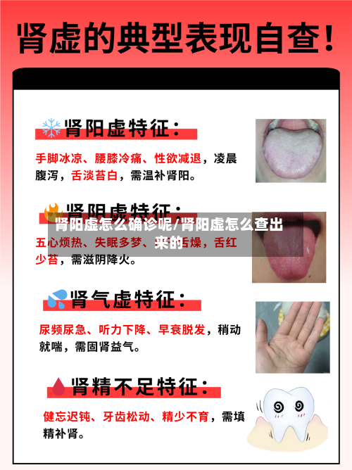 肾阳虚怎么确诊呢/肾阳虚怎么查出来的