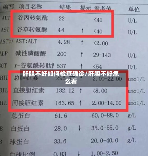 肝胆不好如何检查确诊/肝胆不好怎么看