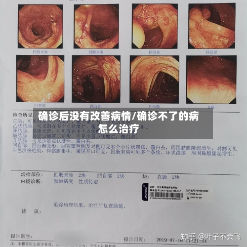 确诊后没有改善病情/确诊不了的病怎么治疗