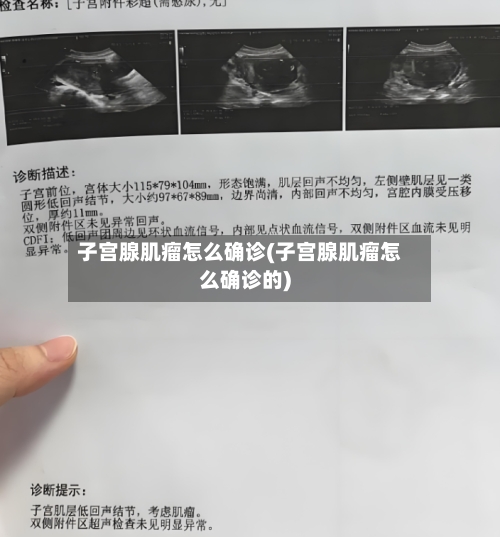子宫腺肌瘤怎么确诊(子宫腺肌瘤怎么确诊的)