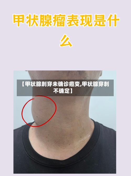 【甲状腺刺穿未确诊癌变,甲状腺穿刺不确定】