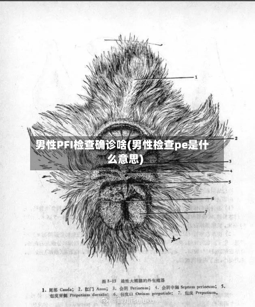 男性PFI检查确诊啥(男性检查pe是什么意思)