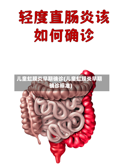 儿童虹膜炎早期确诊(儿童虹膜炎早期确诊标准)