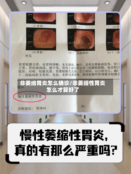 非萎缩胃炎怎么确诊/非萎缩性胃炎怎么才算好了